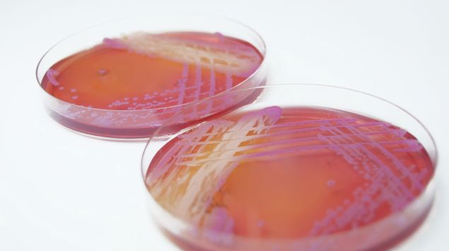 Das Bild zeigt die Bakterienart Staphylococcus aureus in einer Petrischale.