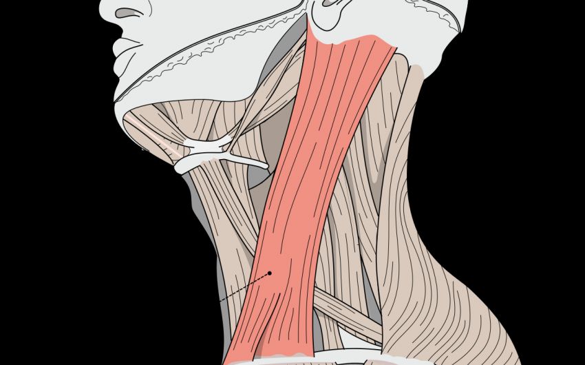 Muskularer Schiefhals Warum Eine Behandlung So Wichtig Ist Onmeda De