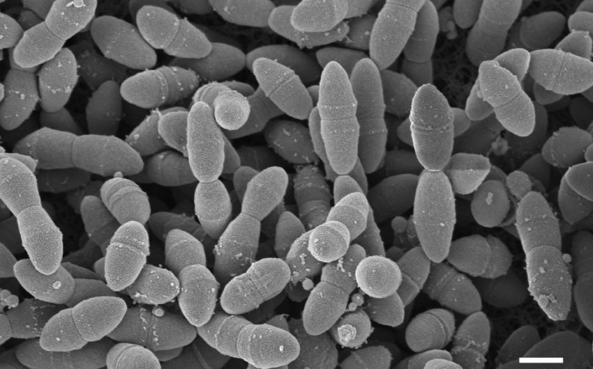 Man sieht eine elektronenmikroskopische Aufnahme von Pneumokokken.