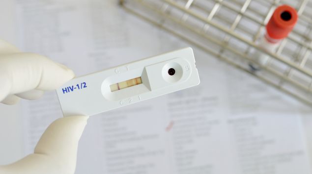 Man sieht einen HIV-Test.