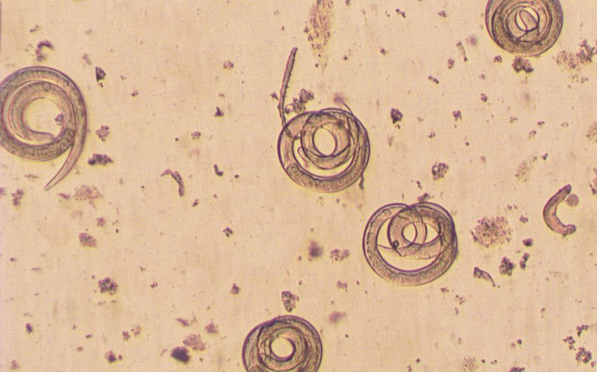 Trichinella spiralis: Man sieht eine mikroskopische Aufnahme von aus der Kapsel befreiten Trichinen.