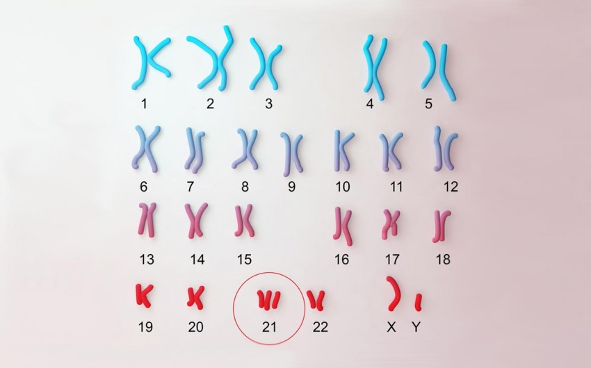 In einer farbigen Illustration ist der Chromosomensatz eines Menschen mit Trisomie 21 dargestellt.