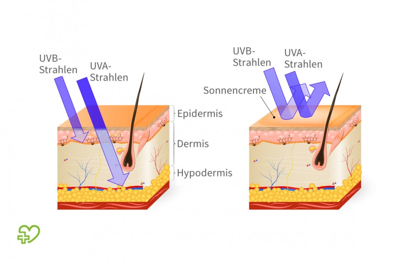 Schematische Darstellung der Eindringtiefe von UV-Strahlung in die Haut.