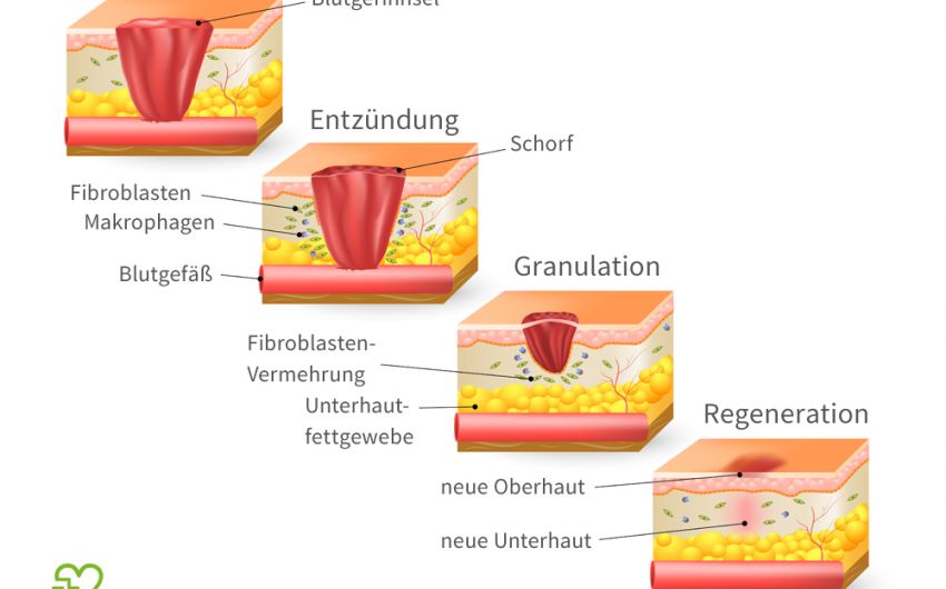Schematische Darstellung der Wundheilung